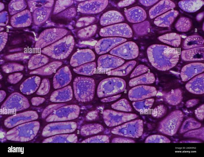 Chondrocyte hypertrophy cartilage articular factors chondrocytes hypertrophic cppd osteoarthritis